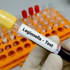 Legionella Legionella