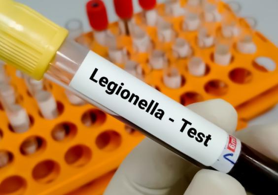 Legionella 